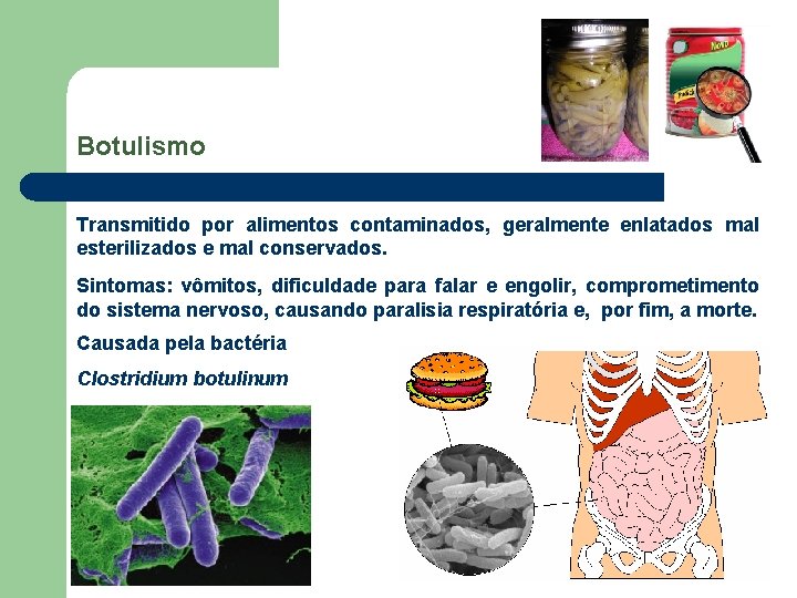 Botulismo Transmitido por alimentos contaminados, geralmente enlatados mal esterilizados e mal conservados. Sintomas: vômitos,