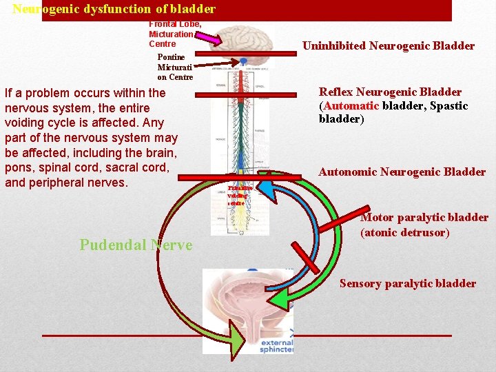 Neurogenic dysfunction of bladder Frontal Lobe, Micturation Centre Uninhibited Neurogenic Bladder Pontine Micturati on Neurogenic dysfunction of bladder Frontal Lobe, Micturation Centre Uninhibited Neurogenic Bladder Pontine Micturati on