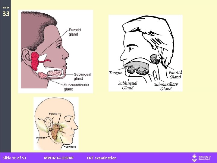 WEEK 33 Slide 16 of 53 MPHM 14 OSPAP ENT examination 