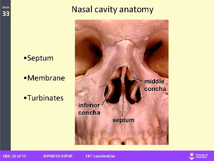 Nasal cavity anatomy WEEK 33 • Septum • Membrane • Turbinates Slide 20 of