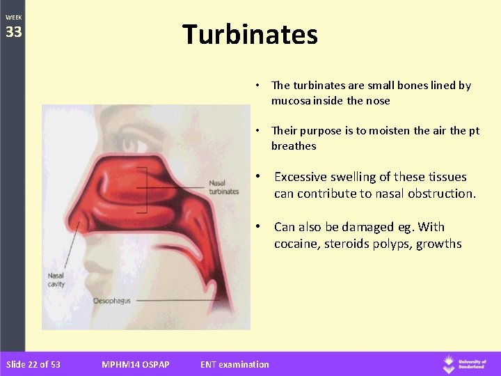 WEEK Turbinates 33 • The turbinates are small bones lined by mucosa inside the