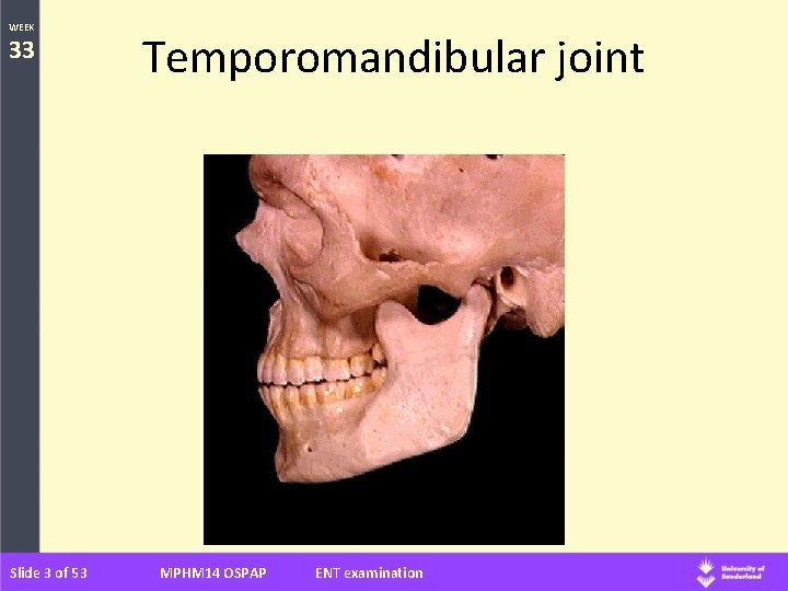 WEEK 33 Slide 3 of 53 Temporomandibular joint MPHM 14 OSPAP ENT examination 