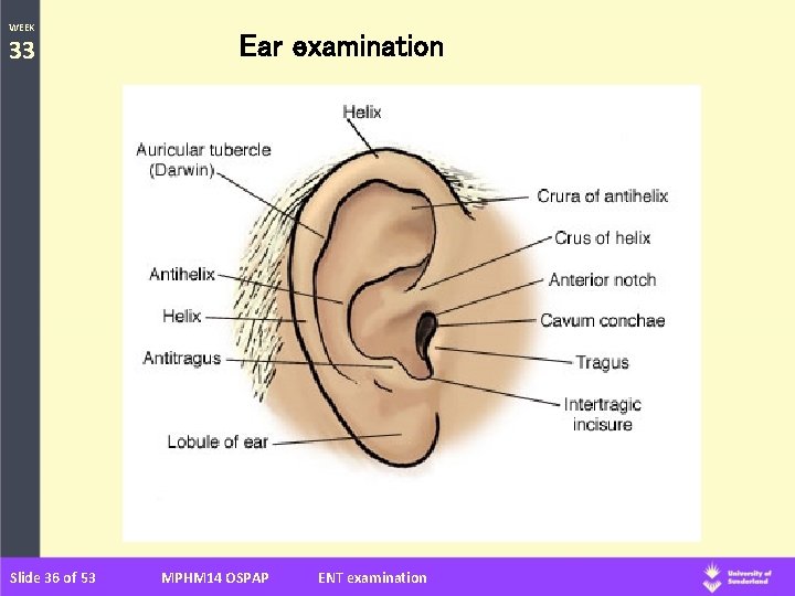 WEEK 33 Slide 36 of 53 Ear examination MPHM 14 OSPAP ENT examination 