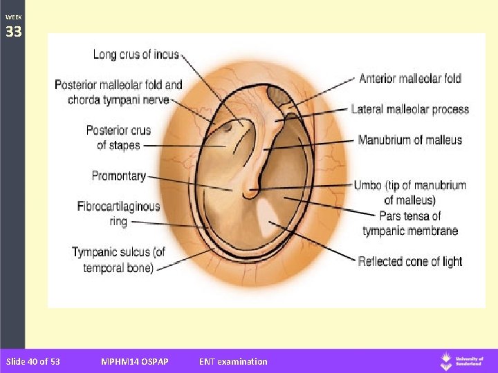 WEEK 33 Slide 40 of 53 MPHM 14 OSPAP ENT examination 