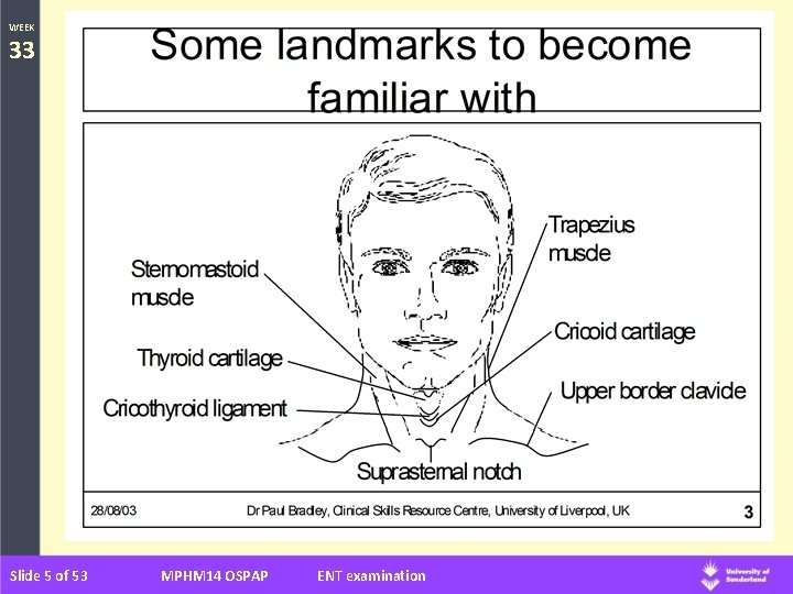 WEEK 33 Slide 5 of 53 MPHM 14 OSPAP ENT examination 