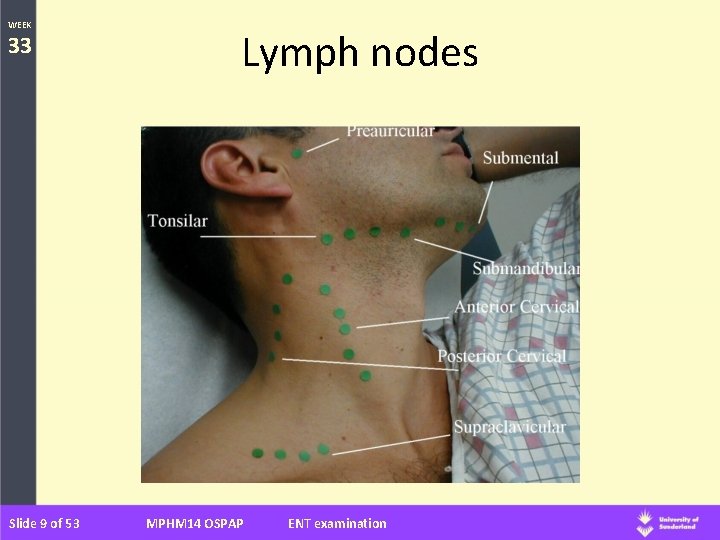 WEEK 33 Slide 9 of 53 Lymph nodes MPHM 14 OSPAP ENT examination 
