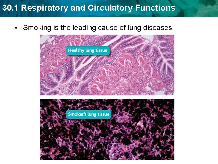 30. 1 Respiratory and Circulatory Functions • Smoking is the leading cause of lung 30. 1 Respiratory and Circulatory Functions • Smoking is the leading cause of lung