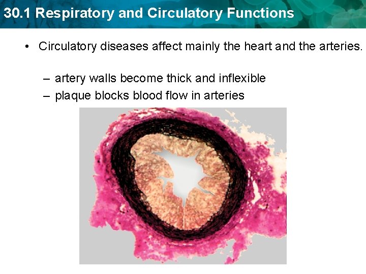 30. 1 Respiratory and Circulatory Functions • Circulatory diseases affect mainly the heart and 30. 1 Respiratory and Circulatory Functions • Circulatory diseases affect mainly the heart and