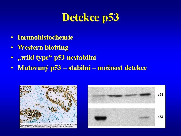 Detekce p 53 • • Imunohistochemie Western blotting „wild type“ p 53 nestabilní Mutovaný