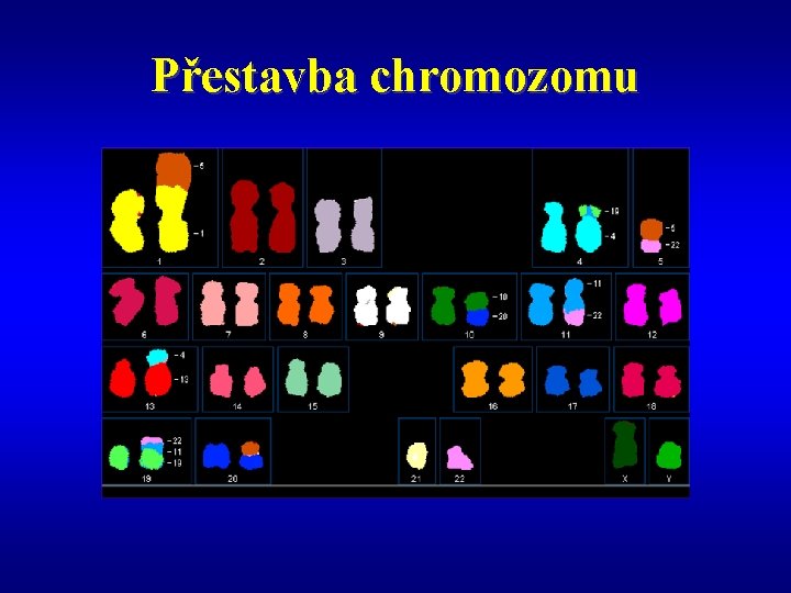 Přestavba chromozomu 