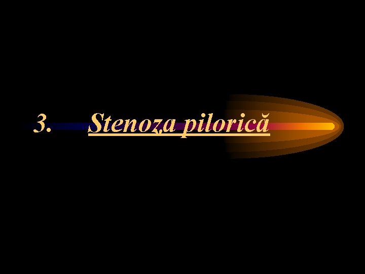 3. Stenoza pilorică 