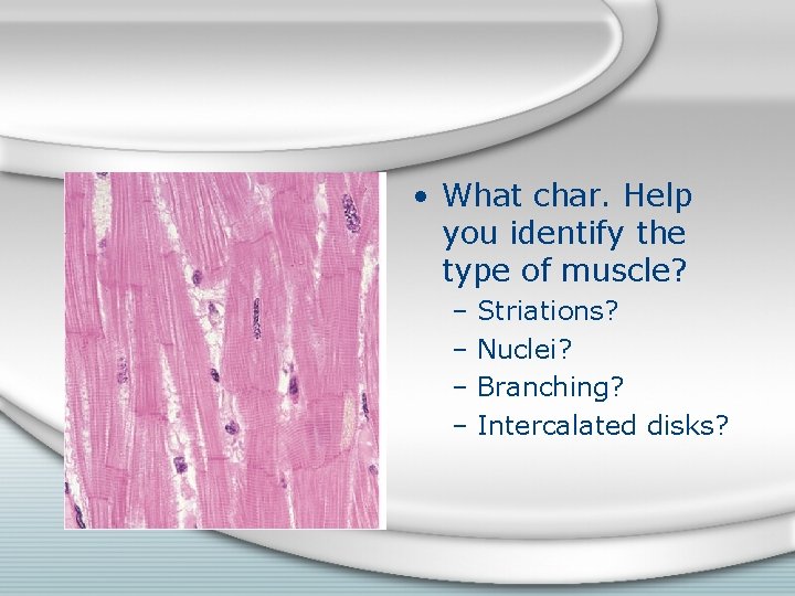  • What char. Help you identify the type of muscle? – Striations? –