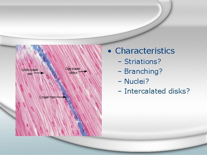  • Characteristics – Striations? – Branching? – Nuclei? – Intercalated disks? 