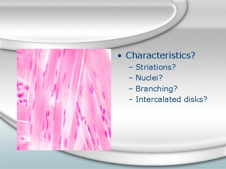  • Characteristics? – Striations? – Nuclei? – Branching? – Intercalated disks? 