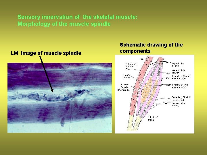 Sensory innervation of the skeletal muscle: Morphology of the muscle spindle LM image of