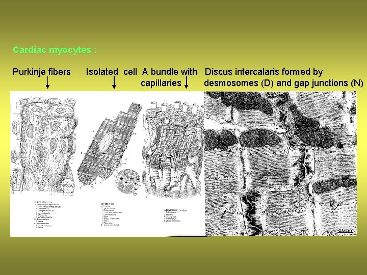 Cardiac myocytes : Purkinje fibers Isolated cell A bundle with Discus intercalaris formed by