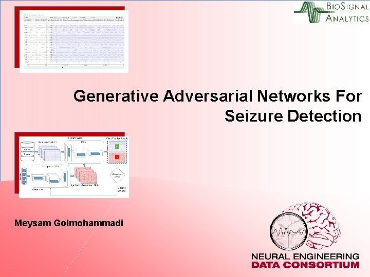 Generative Adversarial Networks For Seizure Detection Meysam Golmohammadi 