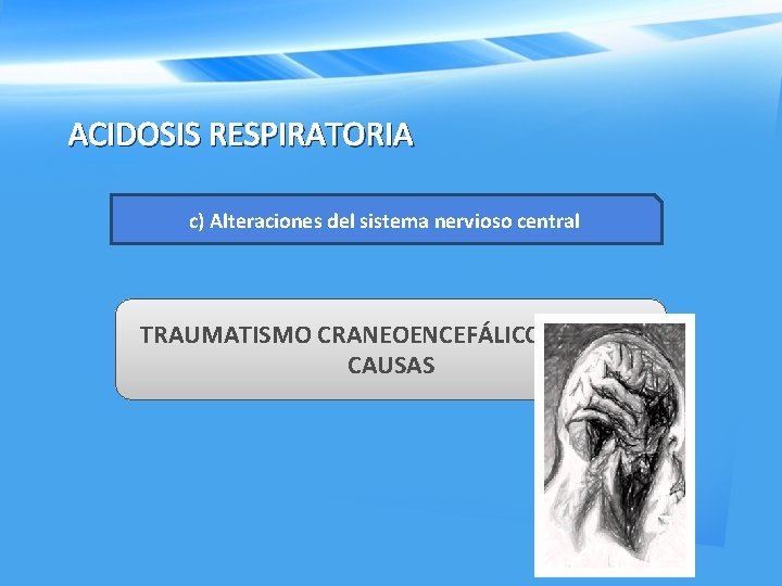 ACIDOSIS RESPIRATORIA c) Alteraciones del sistema nervioso central TRAUMATISMO CRANEOENCEFÁLICO Y OTRAS CAUSAS 