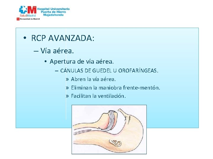  • RCP AVANZADA: – Vía aérea. • Apertura de vía aérea. – CÁNULAS