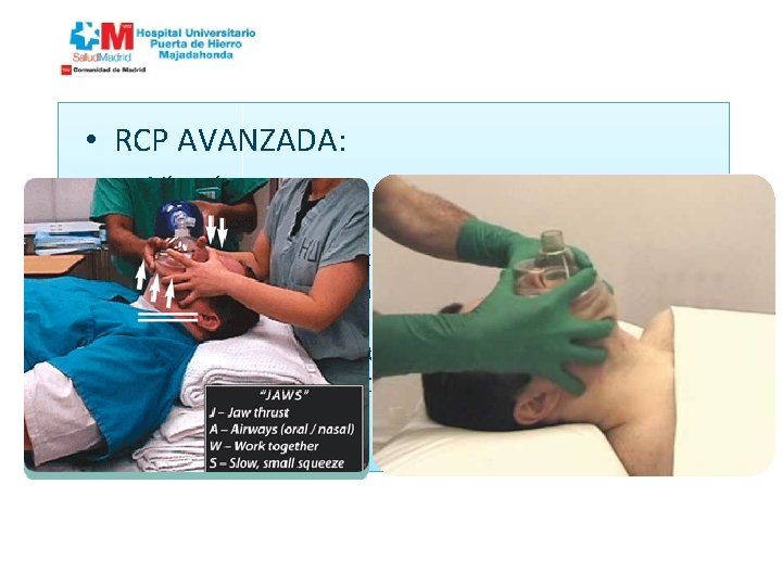  • RCP AVANZADA: – Vía aérea. • Ventilación. – BALÓN AUTOINCHABLE/AMBU® » Evita