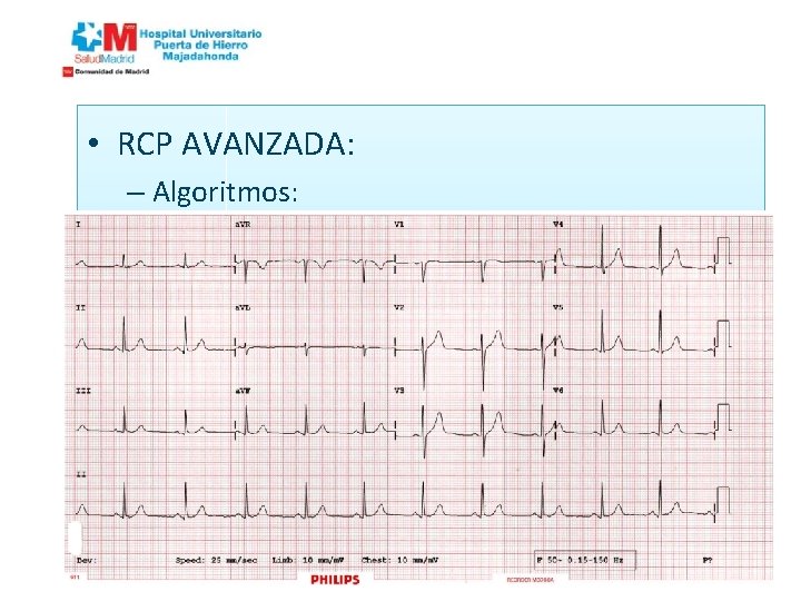  • RCP AVANZADA: – Algoritmos: 