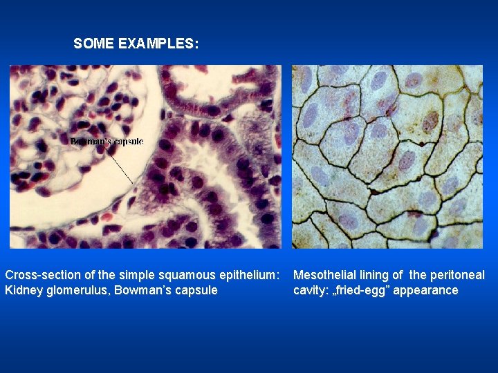 SOME EXAMPLES: Cross-section of the simple squamous epithelium: Kidney glomerulus, Bowman’s capsule Mesothelial lining