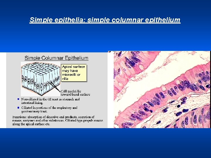 Simple epithelia: simple columnar epithelium 