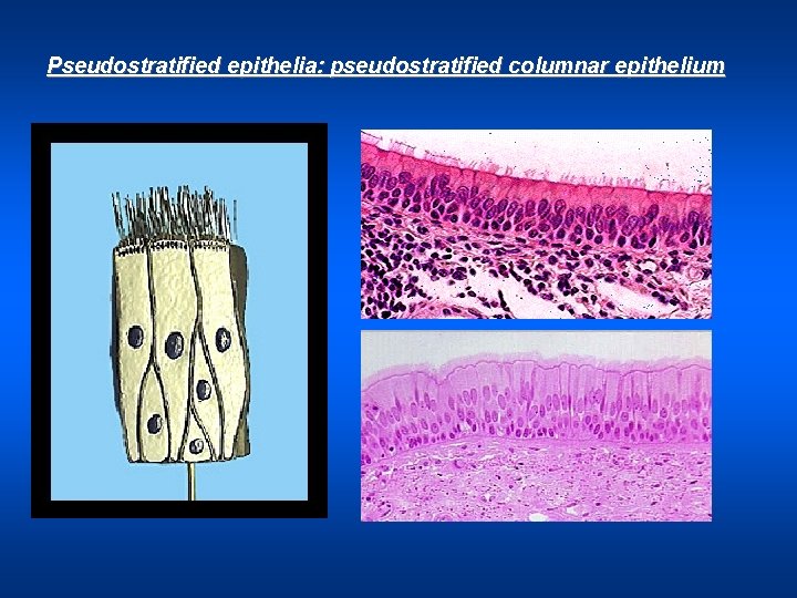 Pseudostratified epithelia: pseudostratified columnar epithelium 