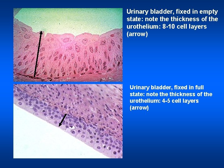 Urinary bladder, fixed in empty state: note thickness of the urothelium: 8 -10 cell