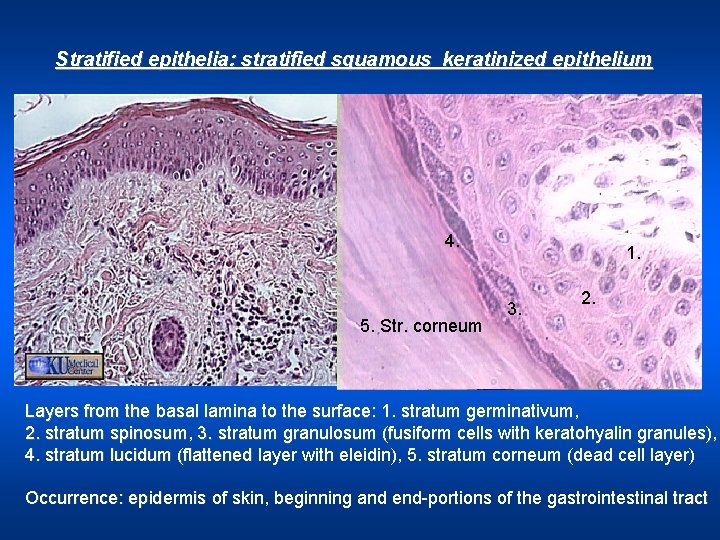 Stratified epithelia: stratified squamous keratinized epithelium 4. 5. Str. corneum 1. 3. 2. Layers