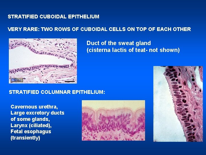 STRATIFIED CUBOIDAL EPITHELIUM VERY RARE: TWO ROWS OF CUBOIDAL CELLS ON TOP OF EACH