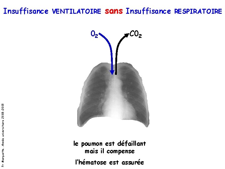 Insuffisance VENTILATOIRE sans Insuffisance RESPIRATOIRE Pr Marquette. Année universitaire 2008 -2009 02 C 02