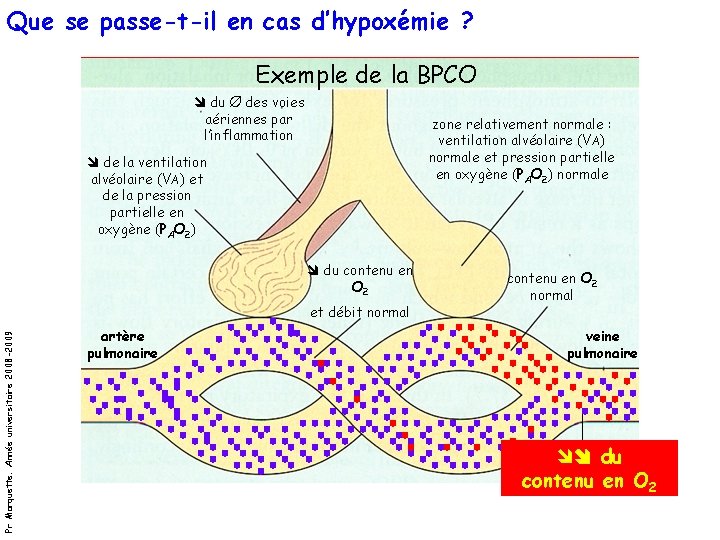 Que se passe-t-il en cas d’hypoxémie ? Exemple de la BPCO du Ø des