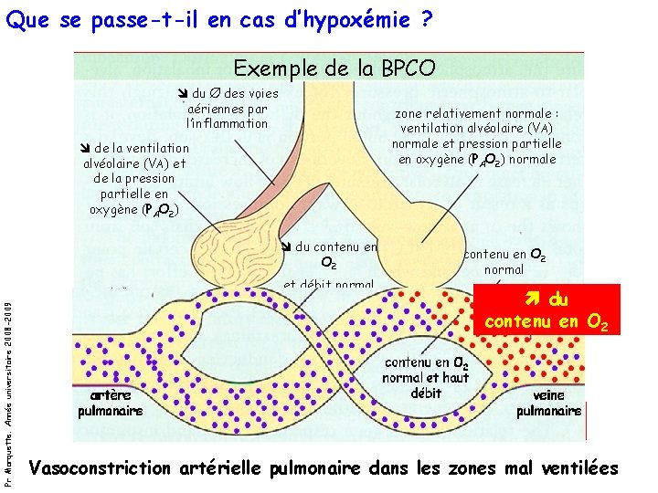 Que se passe-t-il en cas d’hypoxémie ? Exemple de la BPCO du Ø des