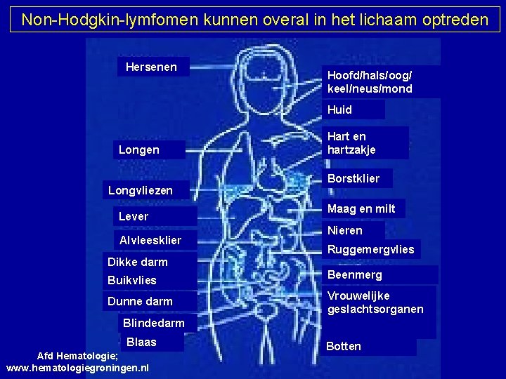 Non-Hodgkin-lymfomen kunnen overal in het lichaam optreden Hersenen Hoofd/hals/oog/ keel/neus/mond Huid Longen Longvliezen Lever