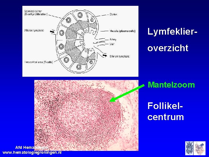 Lymfeklieroverzicht Mantelzoom Follikelcentrum Afd Hematologie; www. hematologiegroningen. nl 