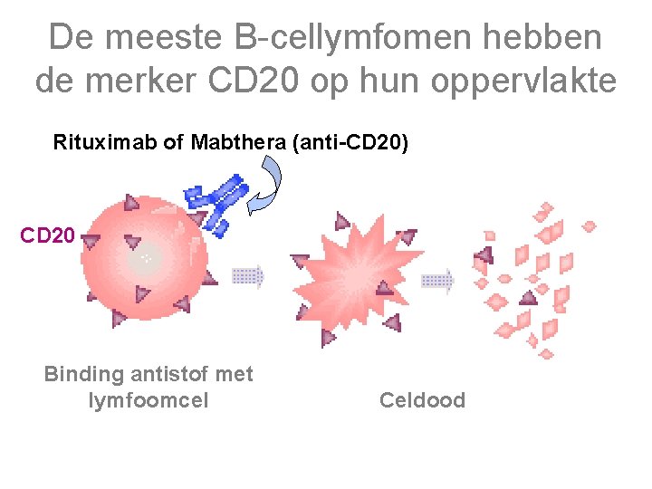 De meeste B-cellymfomen hebben de merker CD 20 op hun oppervlakte Rituximab of Mabthera