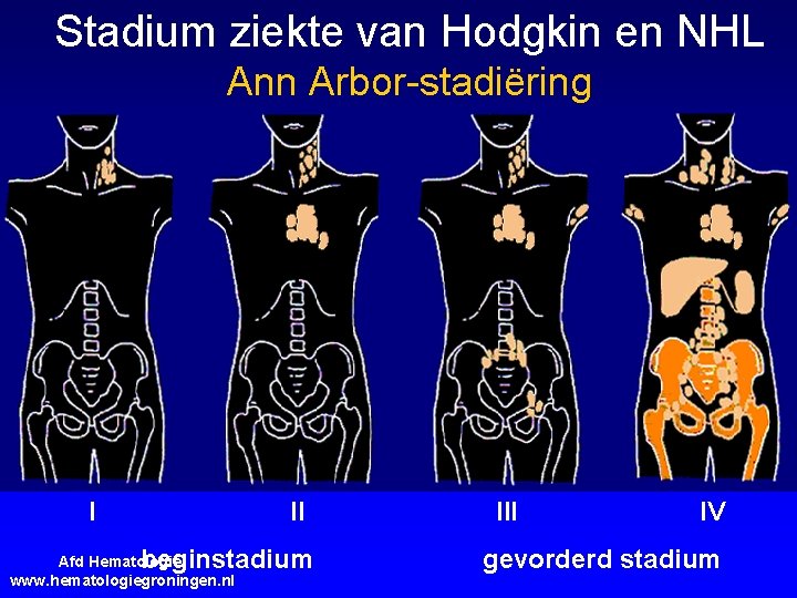 Stadium ziekte van Hodgkin en NHL Ann Arbor-stadiëring I II beginstadium Afd Hematologie; www.