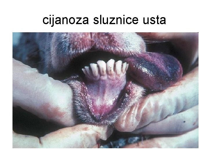 cijanoza sluznice usta 