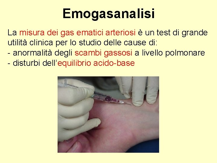 Emogasanalisi La misura dei gas ematici arteriosi è un test di grande utilità clinica