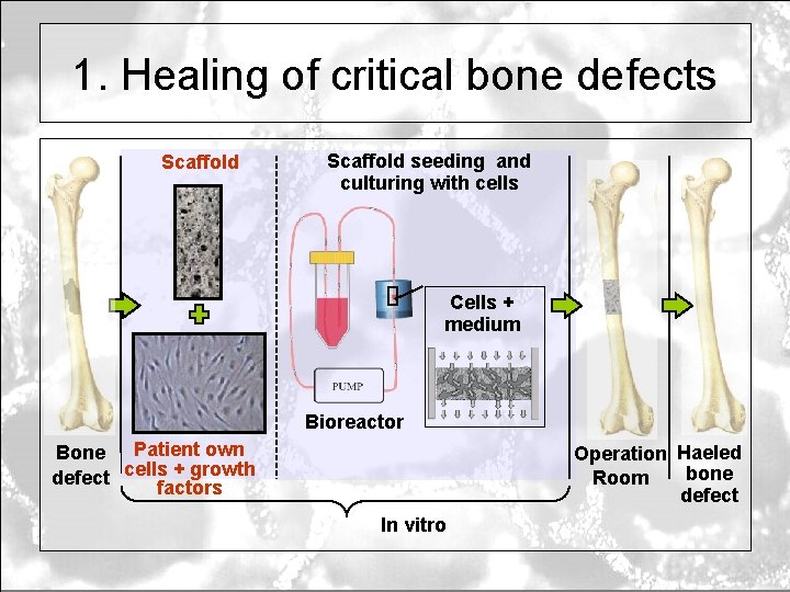 1. Healing of critical bone defects Scaffold seeding and culturing with cells Cells +