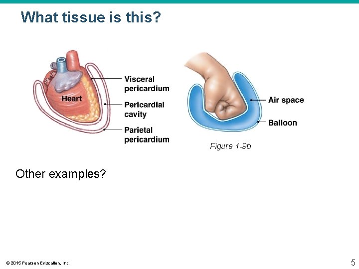 What tissue is this? Figure 1 -9 b Other examples? © 2015 Pearson Education,