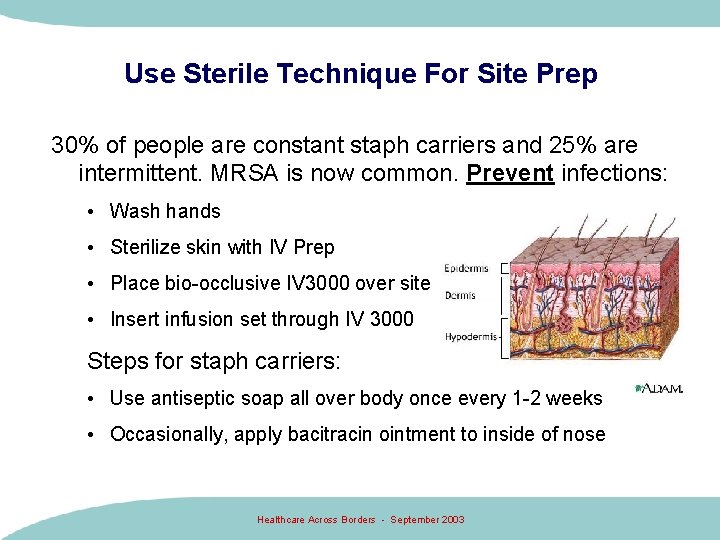 Use Sterile Technique For Site Prep 30% of people are constant staph carriers and Use Sterile Technique For Site Prep 30% of people are constant staph carriers and