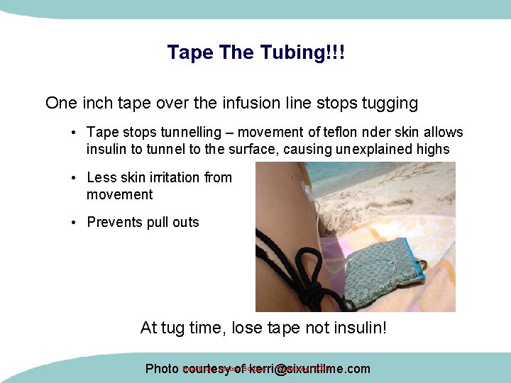 Tape The Tubing!!! One inch tape over the infusion line stops tugging • Tape Tape The Tubing!!! One inch tape over the infusion line stops tugging • Tape