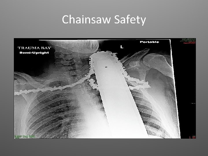 Chainsaw Safety 