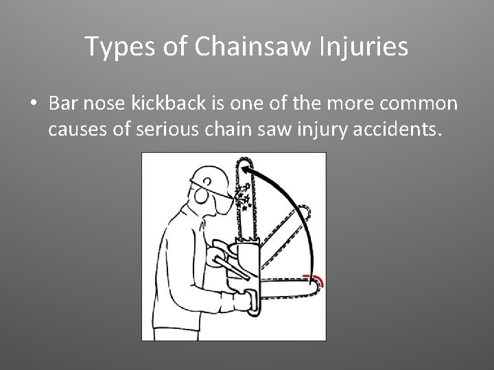 Types of Chainsaw Injuries • Bar nose kickback is one of the more common