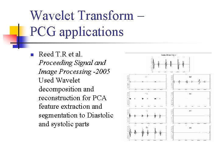 Wavelet Transform – PCG applications n Reed T. R et al. Proceeding Signal and