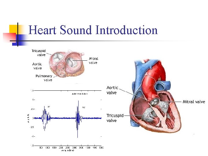 Heart Sound Introduction 