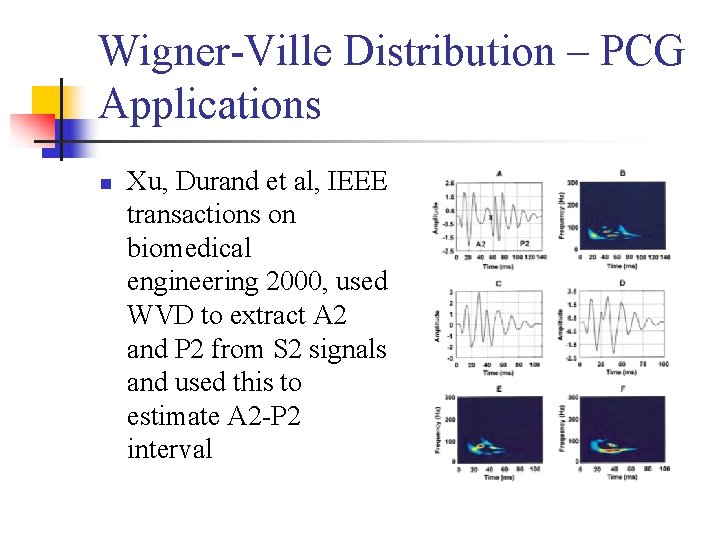 Wigner-Ville Distribution – PCG Applications n Xu, Durand et al, IEEE transactions on biomedical
