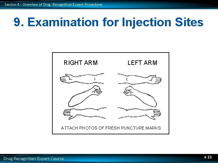 Session 4 – Overview of Drug Recognition Expert Procedures 9. Examination for Injection Sites